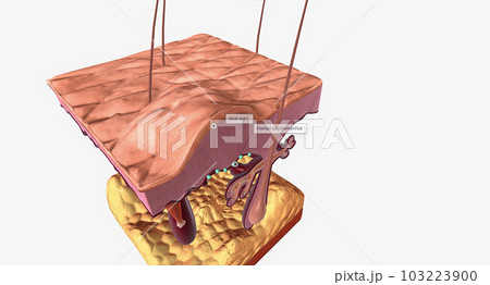 Most anal warts are caused by human papillomavirus (HPV) Most anal warts are caused by human papillomavirus (HPV) 103223900