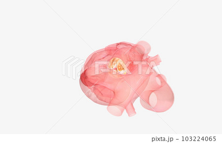 aortic regurgitation or aortic regurgitation 103224065