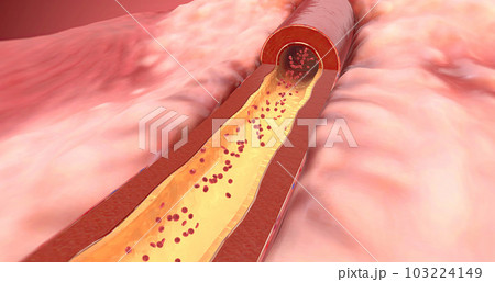 Artery dilates due to increase of ARBs in the blood 103224149