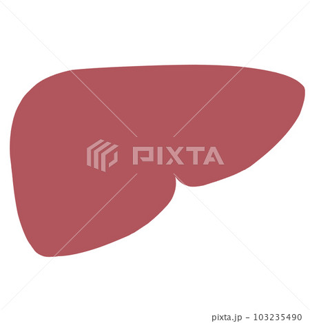 不健康な肝臓のイラスト 不健康な肝臓のイラスト 103235490