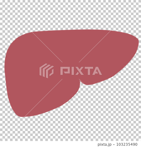 不健康な肝臓のイラスト 不健康な肝臓のイラスト 103235490