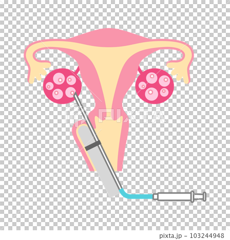 egg collection 插圖 103244948