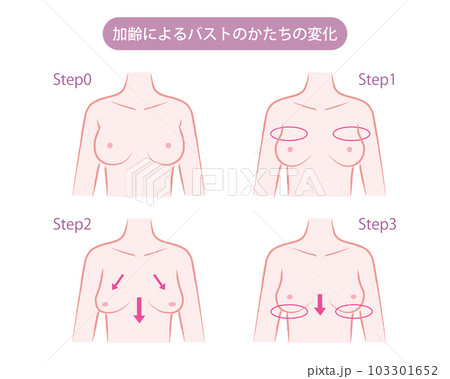 加齢によるバストのかたちの変化のイラスト 加齢によるバストのかたちの変化のイラスト 103301652