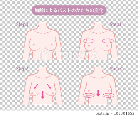 加齢によるバストのかたちの変化のイラスト 加齢によるバストのかたちの変化のイラスト 103301652