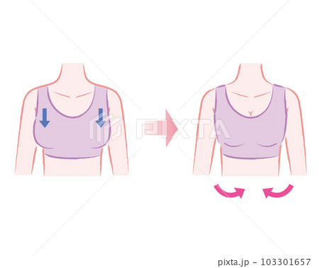 ナイトブラ・補正下着を正しく着用してバストアップするイラスト ビフォーアフター ナイトブラ・補正下着を正しく着用してバストアップするイラスト ビフォーアフター 103301657