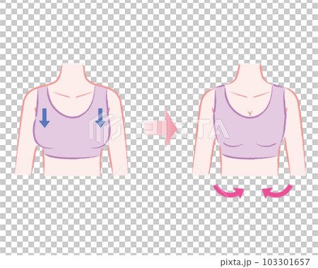 ナイトブラ・補正下着を正しく着用してバストアップするイラスト ビフォーアフター ナイトブラ・補正下着を正しく着用してバストアップするイラスト ビフォーアフター 103301657