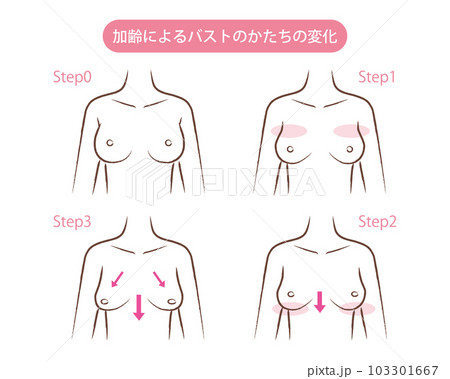 加齢によるバストのかたちの変化のイラスト 加齢によるバストのかたちの変化のイラスト 103301667