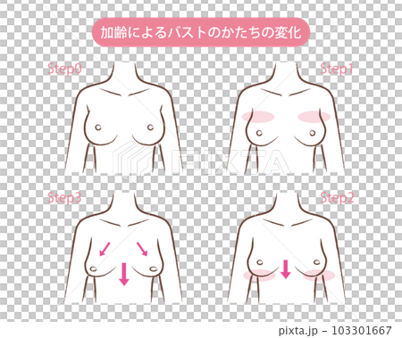 加齢によるバストのかたちの変化のイラスト 加齢によるバストのかたちの変化のイラスト 103301667