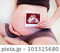 妊娠9ヶ月とエコー写真 103315680