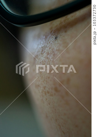 40代男性のシミ 103372730