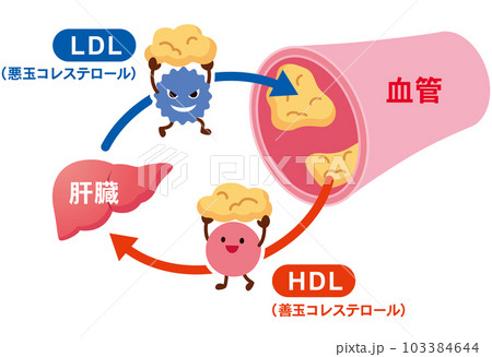 LDLとHDLの仕組み　脂質異常症　血管　コレステロール 103384644