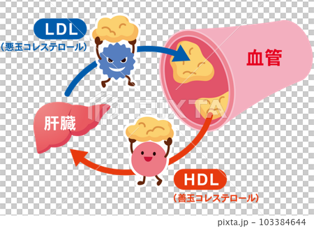 LDLとHDLの仕組み　脂質異常症　血管　コレステロール 103384644