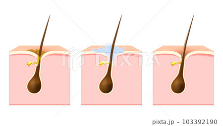 Cleanse the skin pores and hair 103392190