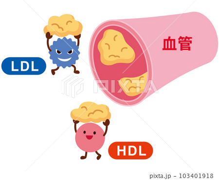 LDLとHDLの仕組み　脂質異常症　血管　コレステロール 103401918