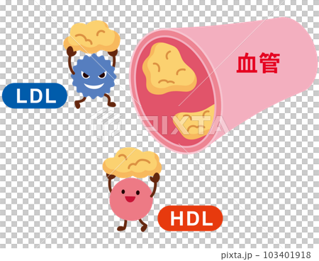 LDLとHDLの仕組み　脂質異常症　血管　コレステロール 103401918