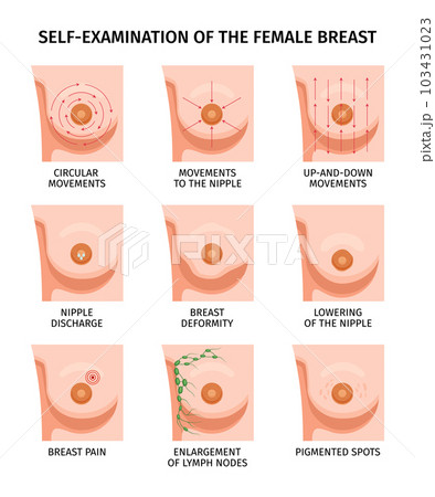 Breast Self Examination Set 103431023