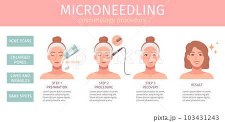 Cosmetology Procedures Infographics 103431243