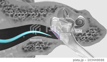 The tympanic membrane (eardrum) separates the external and middle portions of the ear. The tympanic membrane (eardrum) separates the external and middle portions of the ear. 103449086