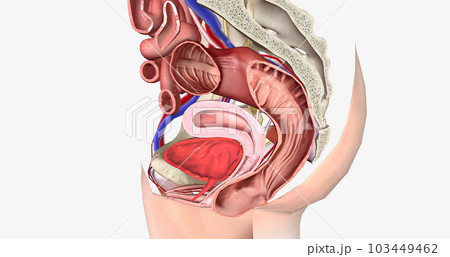Rectum bulge extends outside vaginal space past the vaginal opening 103449462