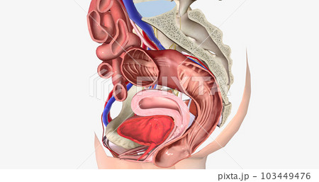 Rectum bulge extends outside vaginal space past the vaginal opening 103449476