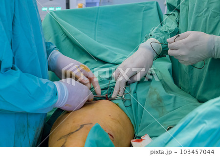 Surgical room is equipped with advanced technology sterile conditions to ensure safe successful varicose vein removal surgery. Surgical room is equipped with advanced technology sterile conditions to ensure safe successful varicose vein removal surgery. 103457044