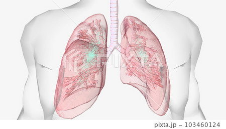 During normal breathing, oxygen rich air enters through your nose or mouth and reaches the lungs through your airways. During normal breathing, oxygen rich air enters through your nose or mouth and reaches the lungs through your airways. 103460124