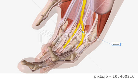 Fibrotic tissue and collagen may accumulate in the mottled, central, spiral, and lateral bands of the palmar aponeurosis or any finger. 103460216