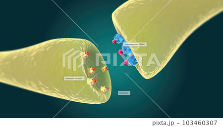 Selective serotonin reuptake inhibitors (SSRIs) are an antidepressant used to treat depression. 103460307