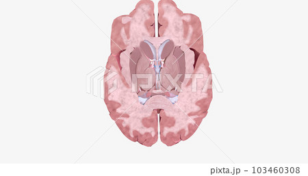 The Brain Transverse (Axial) Cross Section The Brain Transverse (Axial) Cross Section 103460308