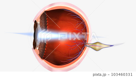 Hyperopia is a common visual condition in which the eye's ability to focus on nearby objects is impaired. 103460331