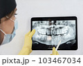 he x-ray is of an old young male female and explains the procedure 103467034