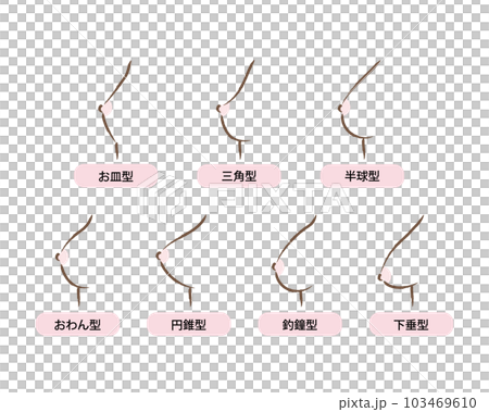 女性胸圍和乳房形狀類型的插圖 女性胸圍和乳房形狀類型的插圖 103469610