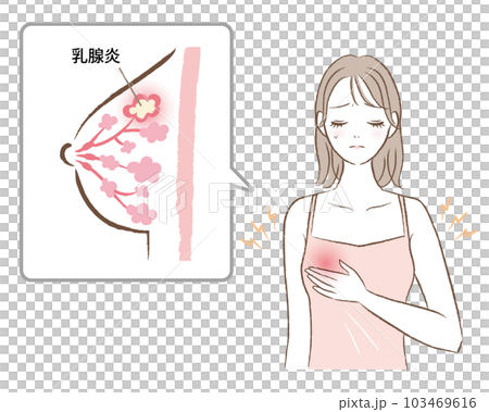 乳腺炎で胸が痛む女性のイラスト 103469616
