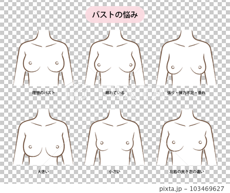 女性のバストの悩みのイラスト（サイズ・かたち） 103469627