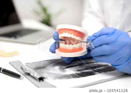 Dentist shows problem areas in teeth 103541126
