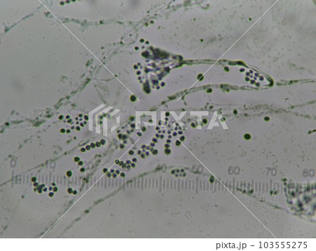 下水道の中に存在するカビ 下水道の中に存在するカビ 103555275