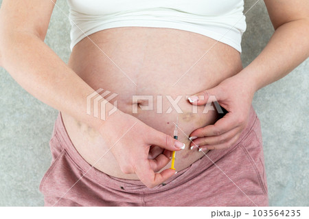 Blood thinners concept. Pregnant woman making injection in stomach Blood thinners concept. Pregnant woman making injection in stomach 103564235