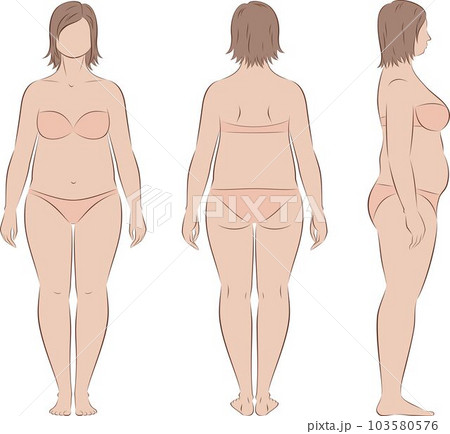 Fat woman figure. Front, back, side. Fat woman figure. Front, back, side. 103580576