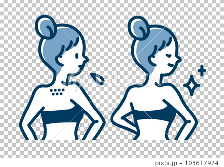 Before and after of a woman who cleaned the pores and unshaving after processing the downy hair on the back Before and after of a woman who cleaned the pores and unshaving after processing the downy hair on the back 103617924