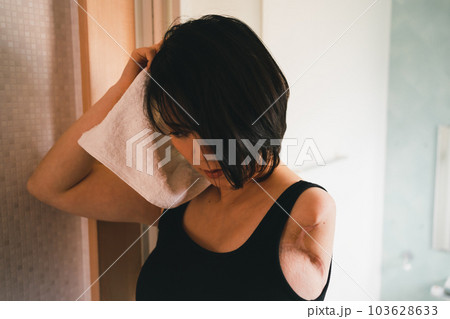 upper limb disability 103628633