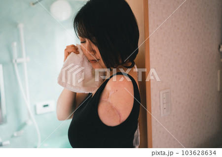 upper limb disability 103628634