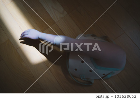 upper limb disability upper limb disability 103628652