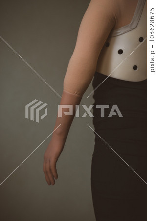 upper limb disability 103628675
