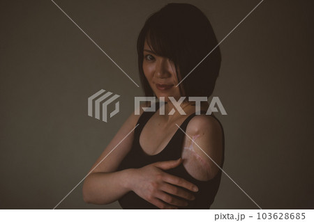upper limb disability 103628685