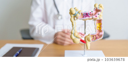 Doctor with human Colon anatomy model. Colonic disease, Large Intestine, Colorectal cancer, Ulcerative colitis, Diverticulitis, Irritable bowel syndrome, Digestive system and Health concept Doctor with human Colon anatomy model. Colonic disease, Large Intestine, Colorectal cancer, Ulcerative colitis, Diverticulitis, Irritable bowel syndrome, Digestive system and Health concept 103639678