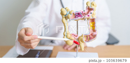 Doctor with human Colon anatomy model. Colonic disease, Large Intestine, Colorectal cancer, Ulcerative colitis, Diverticulitis, Irritable bowel syndrome, Digestive system and Health concept Doctor with human Colon anatomy model. Colonic disease, Large Intestine, Colorectal cancer, Ulcerative colitis, Diverticulitis, Irritable bowel syndrome, Digestive system and Health concept 103639679