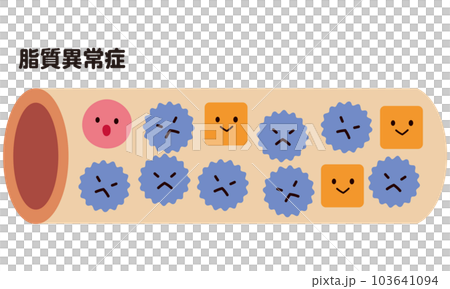 Blood vessels in normal condition and blood vessels with dyslipidemia Cholesterol 103641094