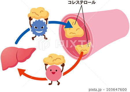 LDLとHDLの仕組み　脂質異常症　血管　コレステロール 103647600