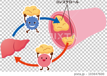 LDLとHDLの仕組み　脂質異常症　血管　コレステロール 103647600