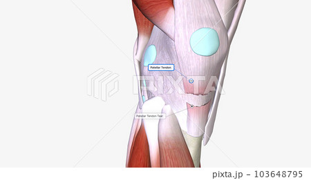 When a tendon is weakened by age or overuse, trauma can cause it to rupture. When a tendon is weakened by age or overuse, trauma can cause it to rupture. 103648795